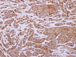 ALDH1A3 Antibody - BSA Free, Novus Biologicals 0.025 mg, Unconjugated:Antibodies,