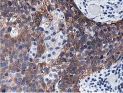 ALDH1L1 Antibody (OTI3D2), Novus Biologicals 0.1mL; Unlabeled:Antibodies,