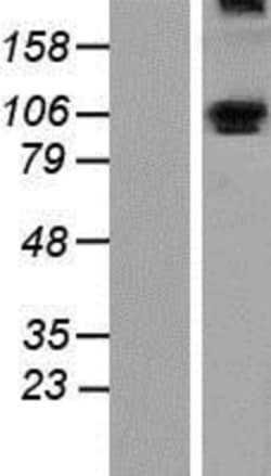 Novus Biologicals&trade;&nbsp;ALDH1L1 Overexpression Lysate