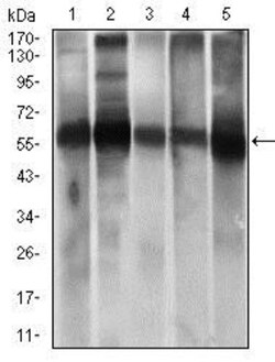 ALDH2 Antibody (4G6A3), Novus Biologicals 0.1mL; Unlabeled:Antibodies,