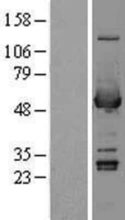 Novus Biologicals&trade;&nbsp;Aldehyde Dehydrogenase 3-A1/ALDH3A1 Overexpression Lysate