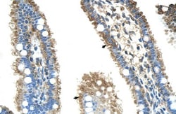 ALDH4A1 Antibody, Novus Biologicals 100&mu;L; Unlabeled:Antibodies, Polyclonal