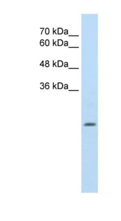ALDH4A1 Antibody, Novus Biologicals 100&mu;L; Unlabeled:Antibodies, Polyclonal