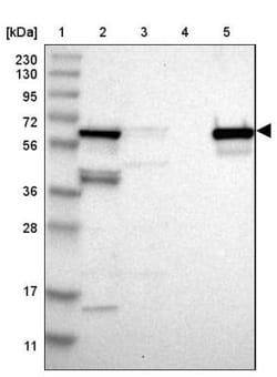 ALDH4A1 Antibody, Novus Biologicals:Antibodies:Primary Antibodies