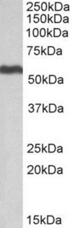 ALDH5A1 Antibody, Novus Biologicals 0.1mg; Unlabeled:Antibodies, Polyclonal
