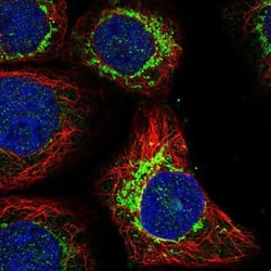 ALDH5A1 Antibody, Novus Biologicals:Antibodies:Primary Antibodies