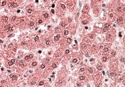 ALDH5A1 Antibody, Novus Biologicals 0.1mg; Unlabeled:Antibodies, Polyclonal
