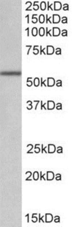 ALDH6A1 Antibody, Novus Biologicals 0.1mg; Unlabeled:Antibodies, Polyclonal