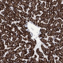 ALDH6A1 Antibody, Novus Biologicals:Antibodies:Primary Antibodies