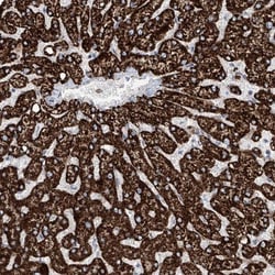 ALDH6A1 Antibody, Novus Biologicals:Antibodies:Primary Antibodies