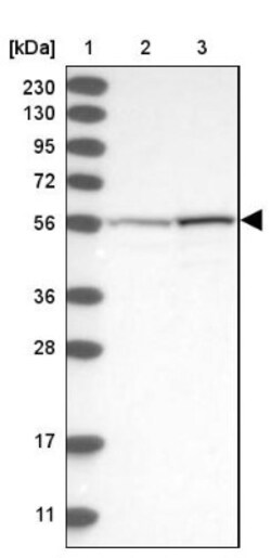 ALDH6A1 Antibody, Novus Biologicals:Antibodies:Primary Antibodies