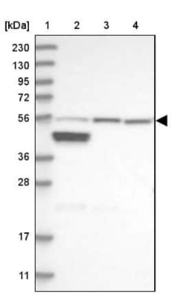 ALDH6A1 Antibody, Novus Biologicals:Antibodies:Primary Antibodies