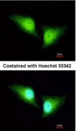 ALDH7A1 Antibody, Novus Biologicals 0.1mL; Unlabeled:Antibodies, Polyclonal