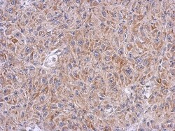 ALDH7A1 Antibody, Novus Biologicals 0.1mL; Unlabeled:Antibodies, Polyclonal