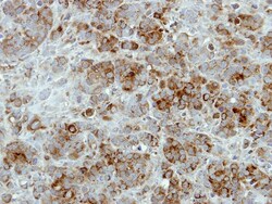 ALDH7A1 Antibody, Novus Biologicals 0.1mL; Unlabeled:Antibodies, Polyclonal