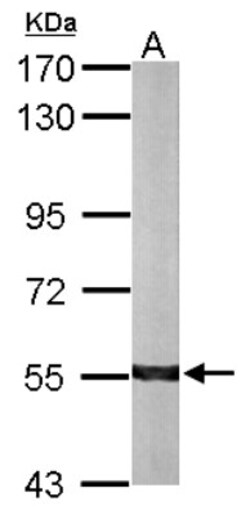 ALDH7A1 Antibody, Novus Biologicals 0.1mL; Unlabeled:Antibodies, Polyclonal