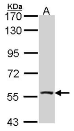 ALDH7A1 Antibody, Novus Biologicals 0.1mL; Unlabeled:Antibodies, Polyclonal