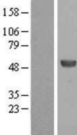 Novus Biologicals&trade;&nbsp;ALDH8A1 Overexpression Lysate