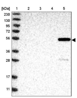 ALDH8A1 Antibody, Novus Biologicals 25 &mu;L | Buy Online | Novus Biologicals | Fisher Scientific