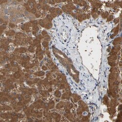 ALDH9A1 Antibody, Novus Biologicals 25 &mu;L; Unlabeled:Antibodies, Polyclonal
