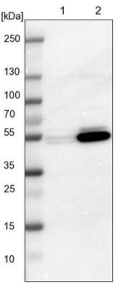 ALDH9A1 Antibody, Novus Biologicals 25 &mu;L; Unlabeled:Antibodies, Polyclonal