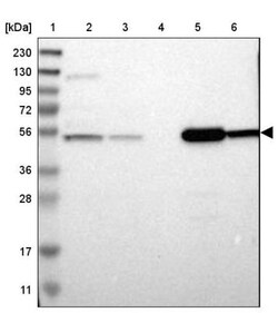 ALDH9A1 Antibody, Novus Biologicals 25 &mu;L; Unlabeled:Antibodies, Polyclonal