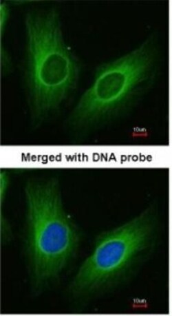 Aldo-keto Reductase 1C3/AKR1C3 Antibody, Novus Biologicals 0.1mg; Unlabeled:Antibodies,