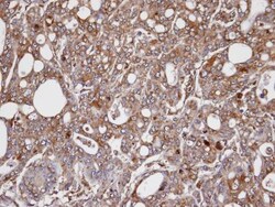 Aldo-keto Reductase 1C3/AKR1C3 Antibody, Novus Biologicals 0.1mg; Unlabeled:Antibodies,