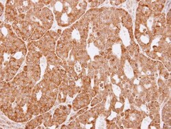 Aldo-keto Reductase 1C3/AKR1C3 Antibody, Novus Biologicals 0.1mg; Unlabeled:Antibodies,