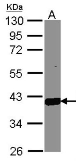Aldo-keto Reductase 1C3/AKR1C3 Antibody, Novus Biologicals 0.1mg; Unlabeled:Antibodies,