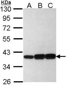 Aldo-keto Reductase 1C3/AKR1C3 Antibody, Novus Biologicals 0.1mg; Unlabeled:Antibodies,