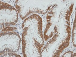 Aldo-keto Reductase 1C4/AKR1C4 Antibody, Novus Biologicals 0.1mL; Unlabeled:Antibodies,
