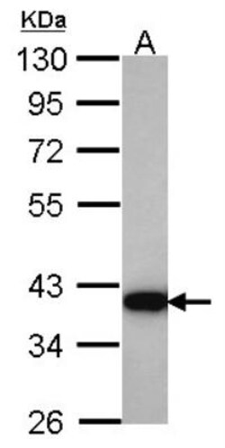 Aldo-keto Reductase 1C4/AKR1C4 Antibody, Novus Biologicals 0.1mL; Unlabeled:Antibodies,