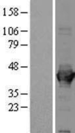 Novus Biologicals&trade;&nbsp;Aldolase A Overexpression Lysate