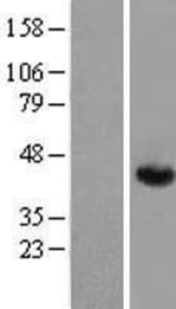 Novus Biologicals&trade;&nbsp;Aldolase A Overexpression Lysate