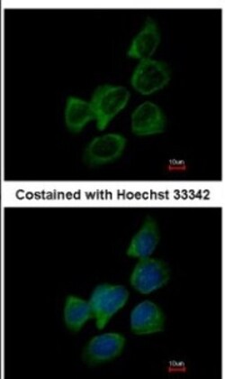 Aldolase B Antibody, Novus Biologicals 0.1mL; Unlabeled:Antibodies, Polyclonal