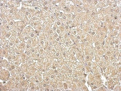 Aldolase B Antibody, Novus Biologicals 0.1mL; Unlabeled:Antibodies, Polyclonal