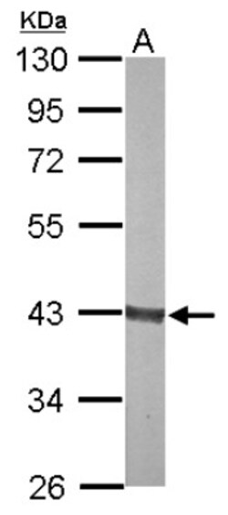 Aldolase B Antibody, Novus Biologicals 0.1mL; Unlabeled:Antibodies, Polyclonal