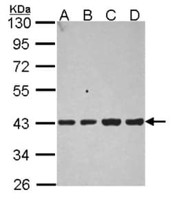 Aldolase B Antibody, Novus Biologicals 0.1mL; Unlabeled:Antibodies, Polyclonal