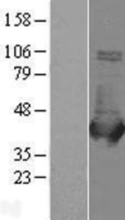 Novus Biologicals&trade;&nbsp;Aldolase B Overexpression Lysate