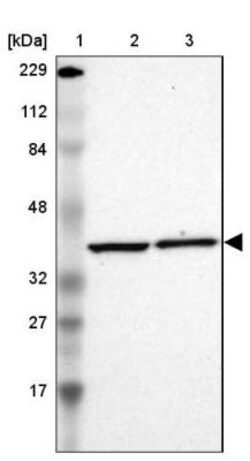 Aldolase A Antibody, Novus Biologicals:Anticorps:Anticorps primaires