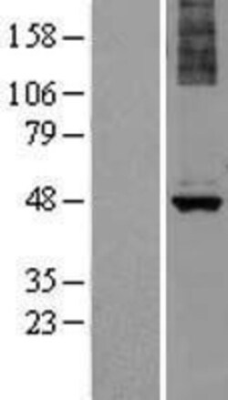 Novus Biologicals&trade;&nbsp;ALG1 Overexpression Lysate