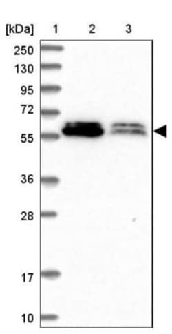 ALG10 Antibody, Novus Biologicals 0.1mL; Unlabeled:Antibodies, Polyclonal