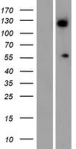 Novus Biologicals&trade;&nbsp;ALG11 Overexpression Lysate