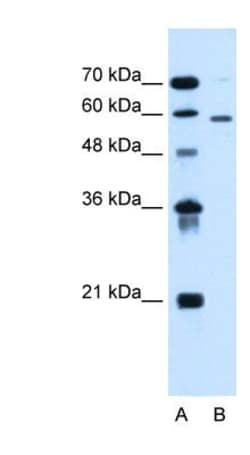 ALG11 Antibody, Novus Biologicals 20&mu;L; Unlabeled:Antibodies, Polyclonal