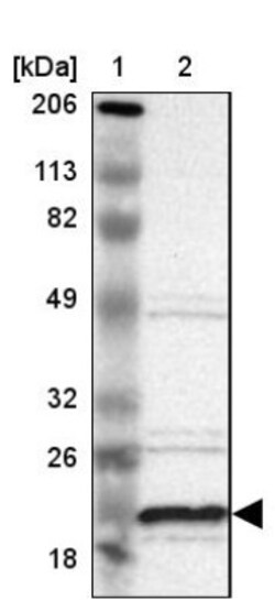 ALG13 Antibody, Novus Biologicals 0.1mL; Unlabeled:Antibodies, Polyclonal