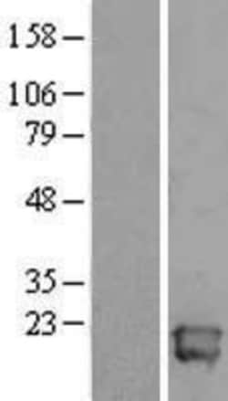 Novus Biologicals&trade;&nbsp;ALG13 Overexpression Lysate