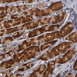 ALG13 Antibody, Novus Biologicals 0.1mL; Unlabeled:Antibodies, Polyclonal