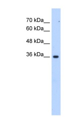 ALG1L6P Antibody, Novus Biologicals 100 &mu;L | Buy Online | Novus Biologicals | Fisher Scientific