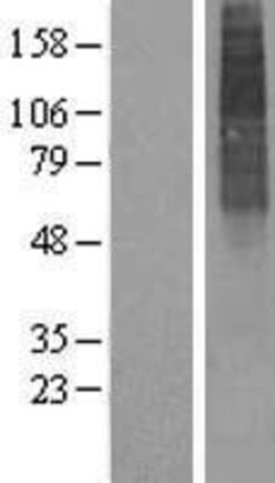 Novus Biologicals&trade;&nbsp;ALG3 Overexpression Lysate